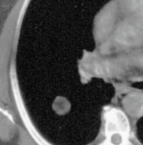 Internal Fat